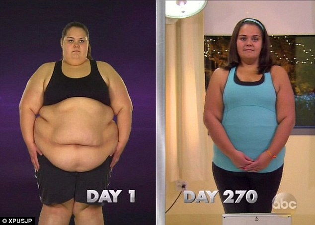 Extreme Weight Loss For Obese